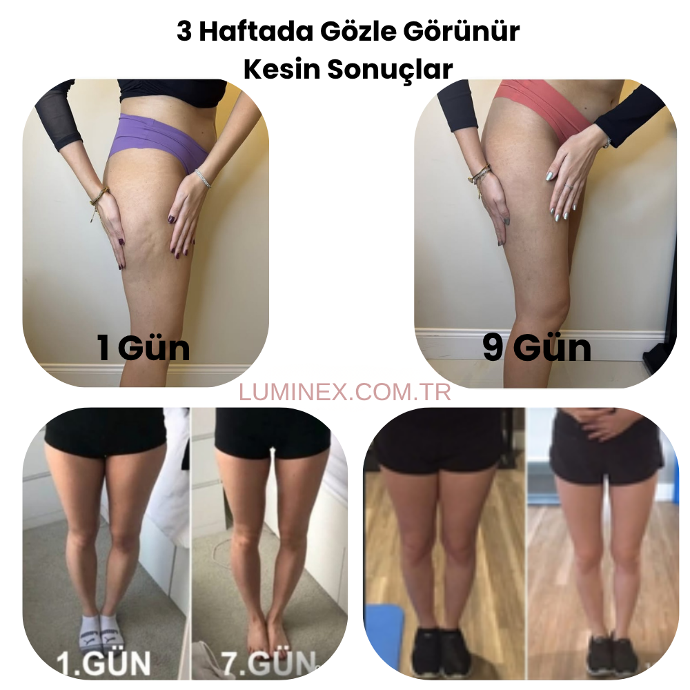 Lumınex-Bacak İncelten ve Sıkılaştıran Masaj Aleti